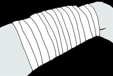 Lår, trykkbandasje bilde#2