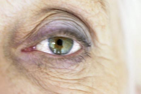 Eye of an old person