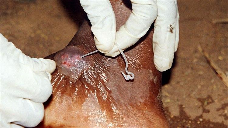 Foto: The Carter Center