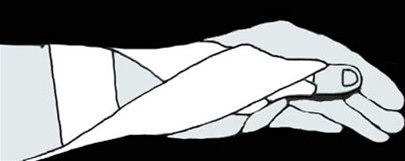 Tommelstøtte bilde #2