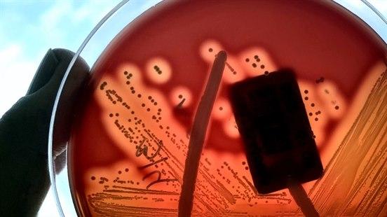 Fotoet viser en petriskål og to fingre til en person som holder skålen i hånda. Kolonier av gruppe A streptokokker har vokst på blodagar-vekstmedium. 