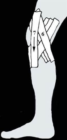 Kneleddsteiping bilde#2