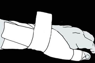 Tommelstøtte bilde #4