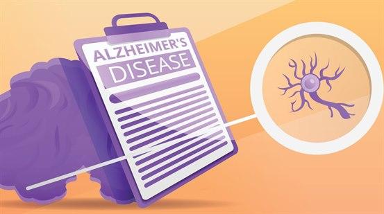 Illustrasjon med plakat hvor det står Alzheimers sykdom og en tegning av en nervecelle.