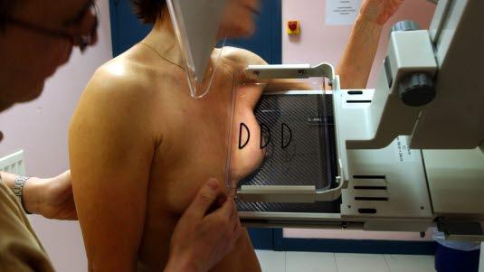 mammografi2