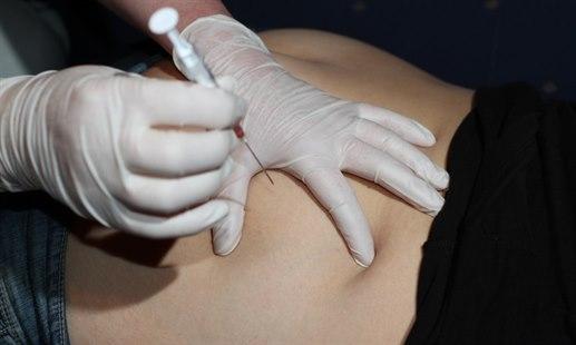 Intramuskulær injeksjon