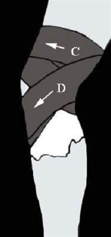 Kneleddsteiping bilde#7