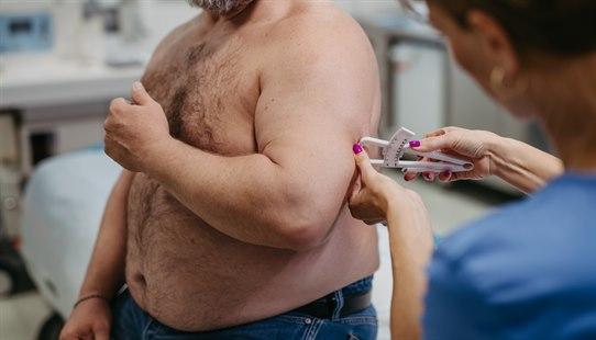 Illustrasjonsfoto av en overvektig mann på legekontor får målt fettprosent