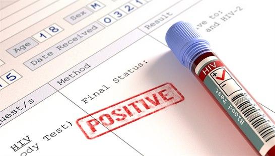 Illustrasjonsfoto av et positivt HIV-testresultat sammen med et blodprøveglass. 