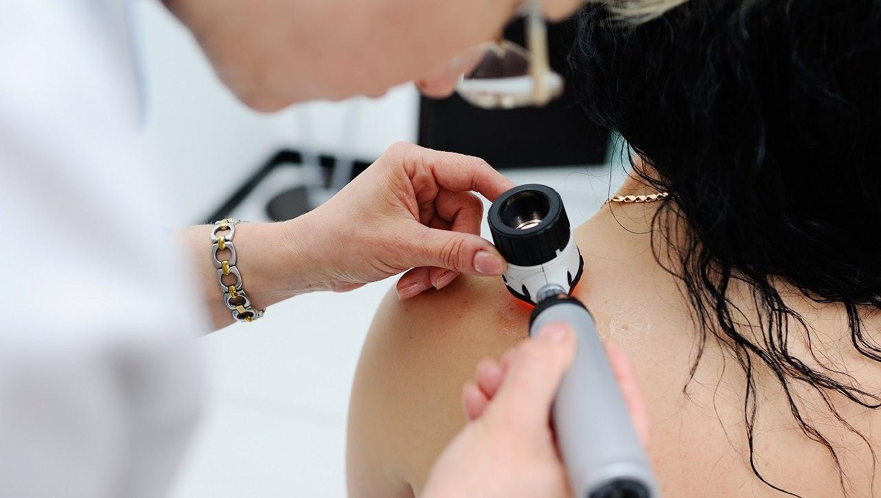 dermatoscopic inspection