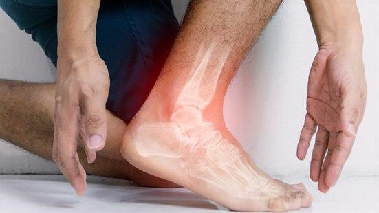 Illustrasjonsfotoet viser nærbilde av ankel og fot 