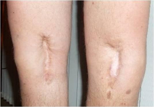 Knærne til Westlie i dag.