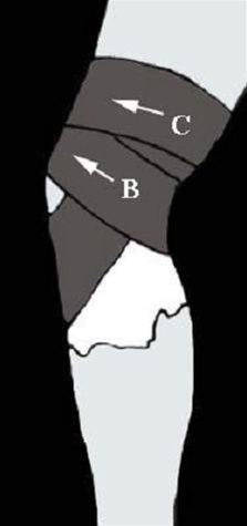 Kneleddsteiping bilde#6