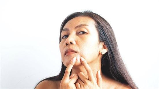 Kviser i voksen alder