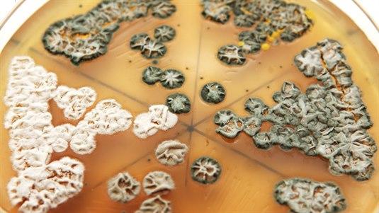 agar bakteriedyrkning