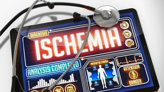 Iskemi