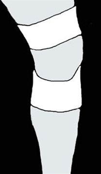 Kneleddsstøtte bilde#7