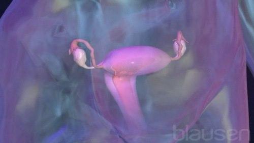 Fjerning av eggstokk