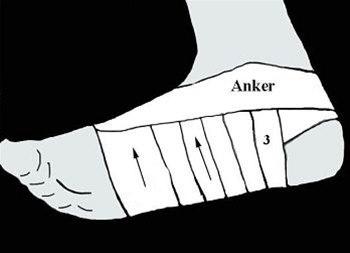 Fotsåleteiping bilde#5