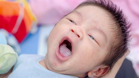 Illustrasjonsfotoet av et spedbarn med trøske på tungen