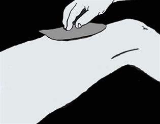 Lår, trykkbandasje bilde#3