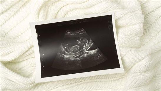 Illustrative photo of an ultrasound picture of a human embryo