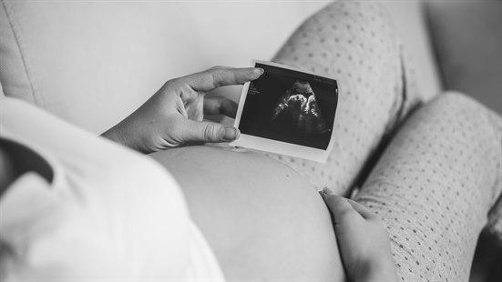 Gravid dame ligger på sofaen og holder et ultralyd-bilde mens hun holder seg på magen