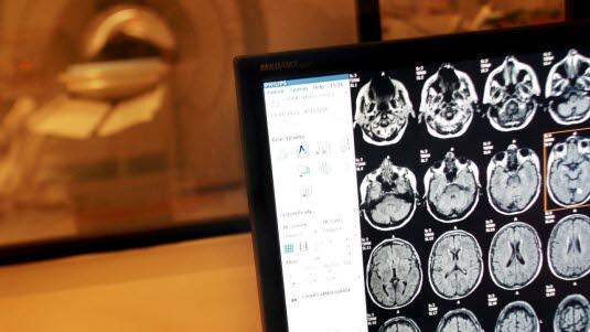 MR, undersøkelse,hjernen.jpg