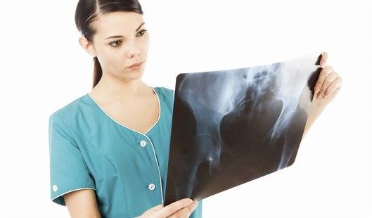 Illustrasjonsfotoet viser en kvinne som vurderer et røntgenbildet av bekkenet