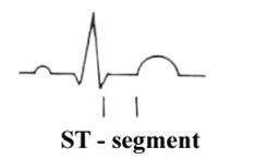 ST-segment