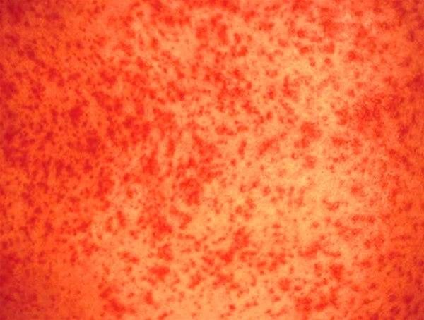 Legemiddelreaksjon 2