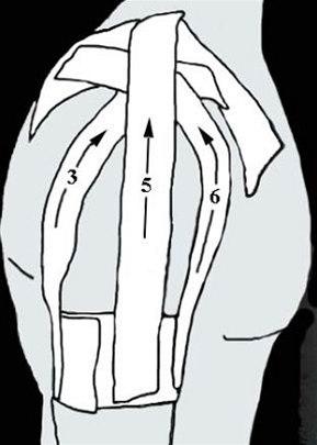 Skulderleddsteiping bilde#3