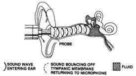 Tympanometer sender lydbølger
