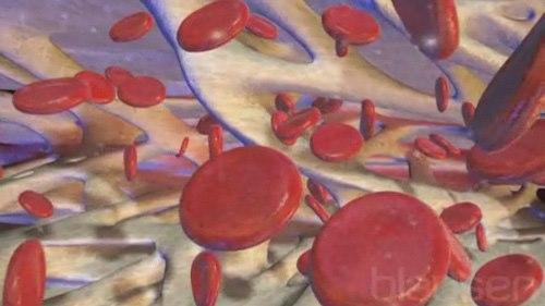 268 Chemotherapy Induced Anemia Swed 768x432-268