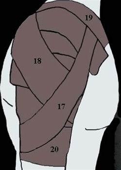 Skulderleddsteiping bilde#8