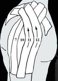 Skulderleddsteiping bilde#6