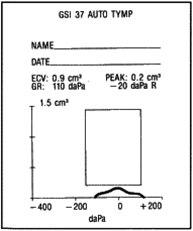 Tympanogram, mulig serøs otitt