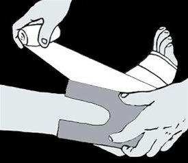 Ankel, trykkbandasje bilde#2