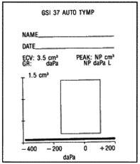 Tympanogram, perforert trommehinne