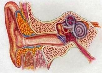 Mellomørebetennelse, akutt bilde#3