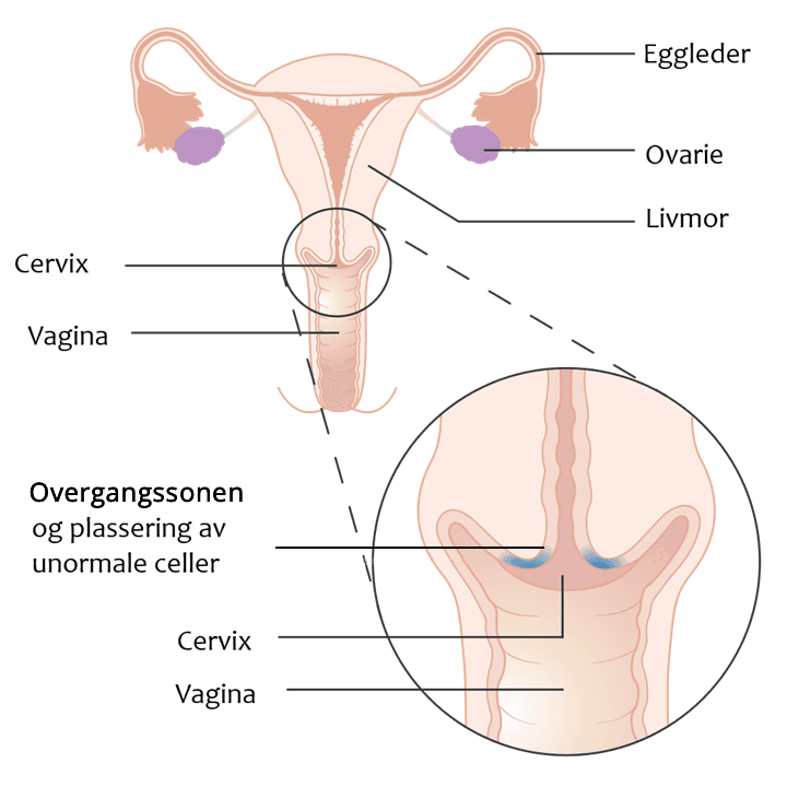 Indre kjønnsorganer kvinne_ cervix.png