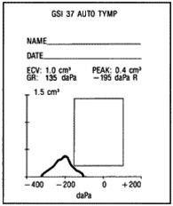 Tympanogram, tuba Eustachi, dårlig funksjon