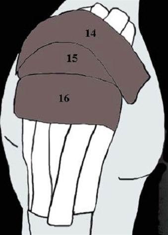 Skulderleddsteiping bilde#7