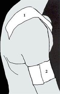 Skulderleddsteiping bilde#2