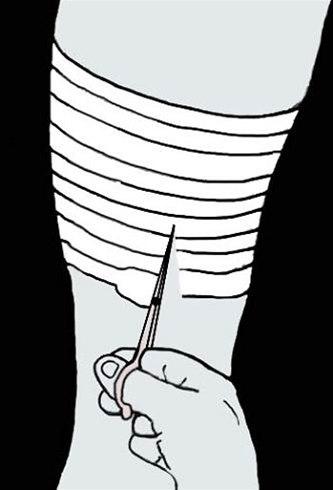 Låret, muskelskader, teiping bilde#2