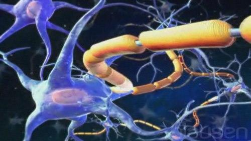 Amyotrofisk lateralsklerose, ALS