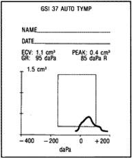 Tympanogram, forkjølelse, nesetetthet