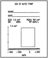 Tympanogram, serøs otitis media