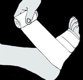 Ankel, trykkbandasje bilde#1