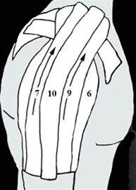 Skulderleddsteiping bilde#5